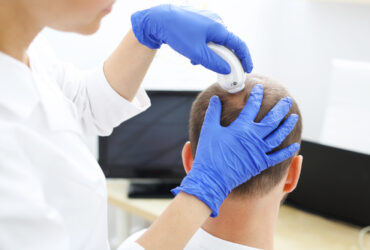 Prp Hair Treatment in Chennai