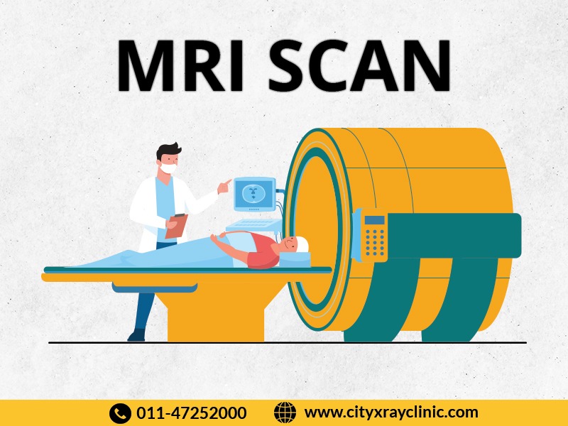 MRI Scan Near Me At Affordable Price | Book A MRI Scan Now!