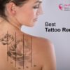 Best Laser Tattoo Removal in Bangalore – Guaranteed Results