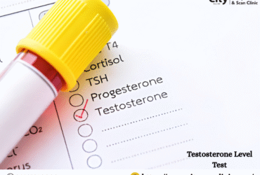 Testosterone Level Test Price Guide & What to Expect