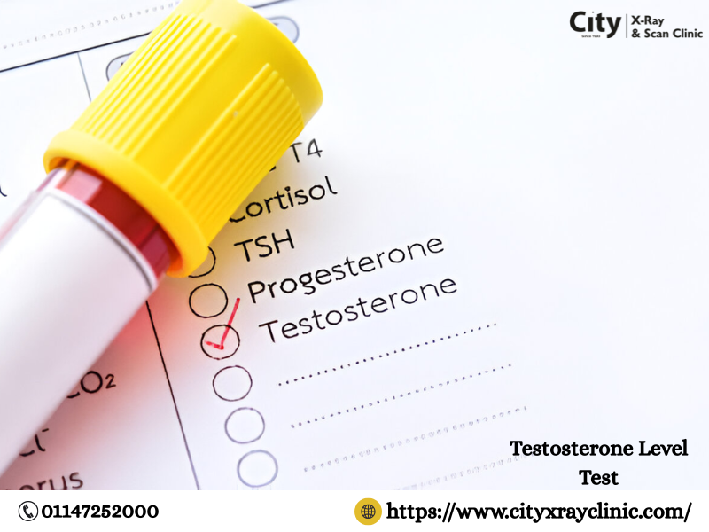 Testosterone Level Test Price Guide & What to Expect